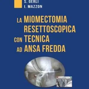 Di Tendenza La miomectomia resettoscopica con tecnica ad ansa fredda