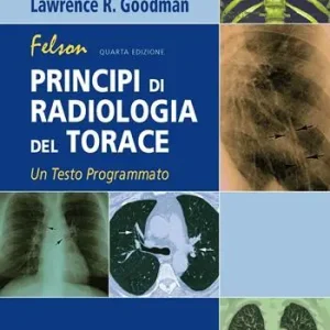 Sconto Felson. Principi di radiologia del torace. Un testo programmato