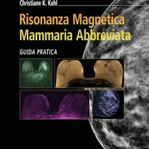 Risonanza magnetica mammaria abbreviata. Guida pratica Direttamente Dal Produttore