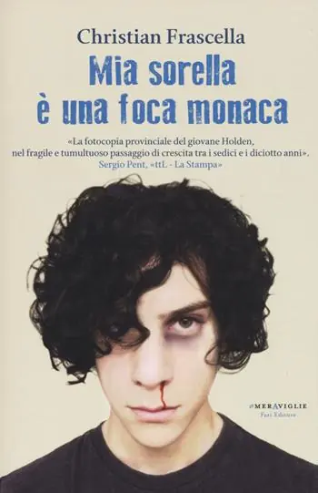 Mia sorella è una foca monaca Professionale