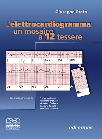 Elettrocardiogramma un mosaico a 12 tessere Miglior Prezzo