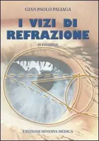 I vizi di refrazione Solo Oggi