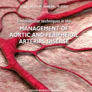 Promozione Esclusiva Endovascular techniques in the management of aortic and peripheral arterial disease