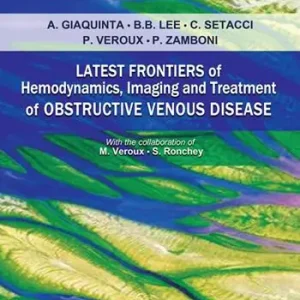 Economico Latest frontiers of hemodynamics, imaging and treatment of obstructive venous disease