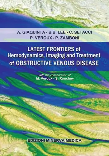 Economico Latest frontiers of hemodynamics, imaging and treatment of obstructive venous disease