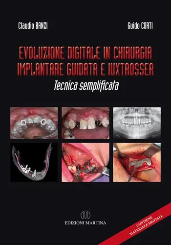 Evoluzione digitale in chirurgia implantare guidata e iuxtaossea. Tecnica semplificata. Ediz. italiana e inglese. Con QR Code Nuova Collezione